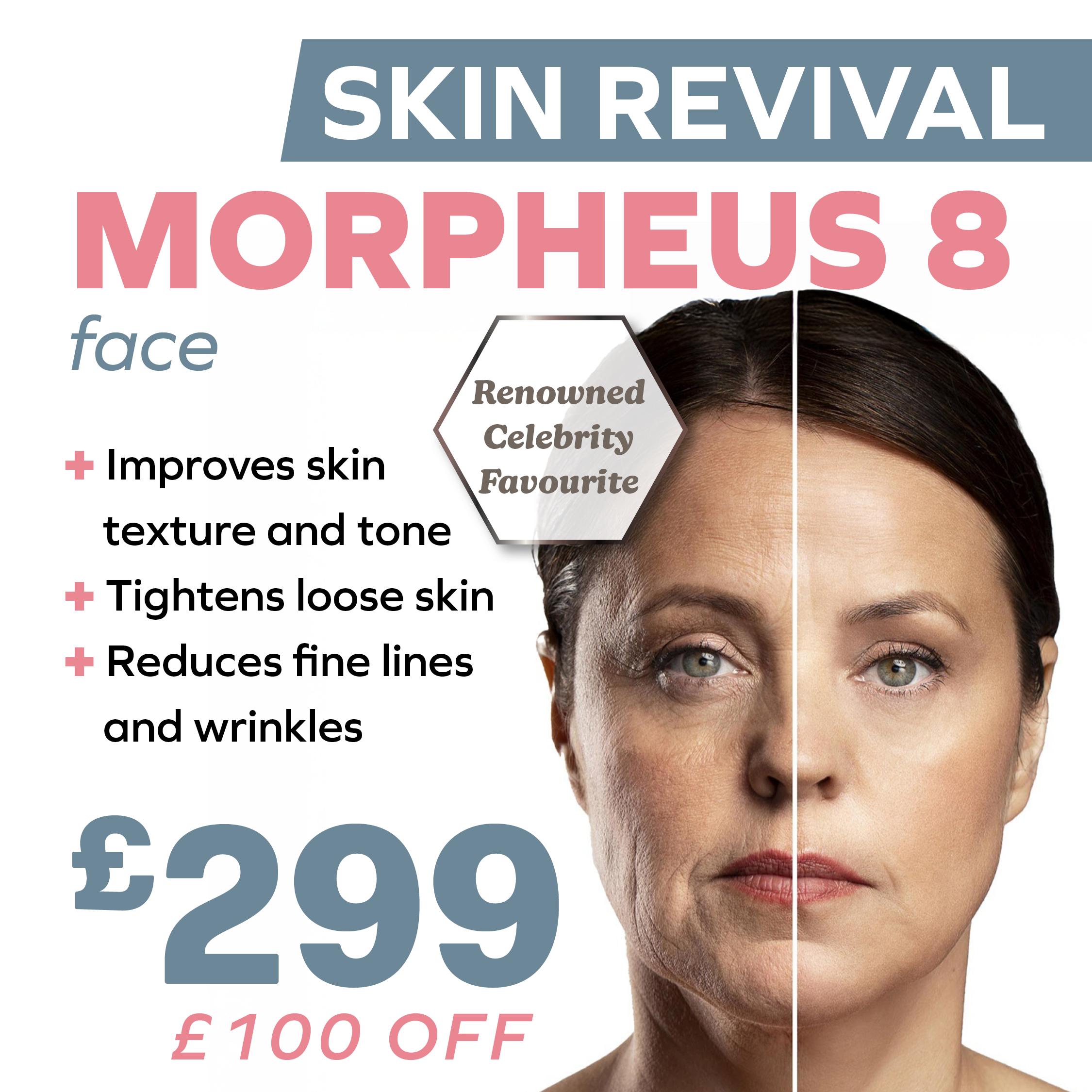 Morpheus 8 Face £299